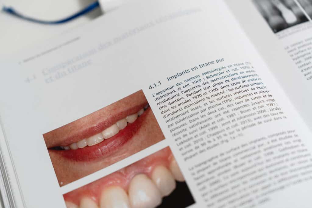 Dental implant, dental health, oral surgery, tooth replacement, dental care, Swiss dental clinic, Ardentis.