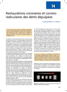 Image montrant une restauration coronaire et une reconstruction dentaire avec des outils et matériaux dentaires.