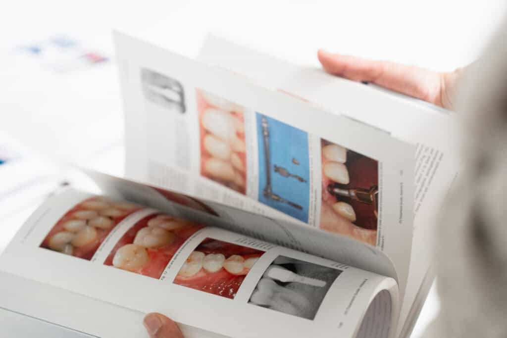 Livre d’implantologie ouvert avec illustrations cliniques dentaires