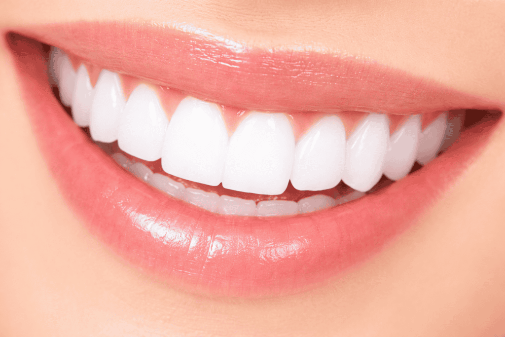 Sourire avec dents blanches et alignées