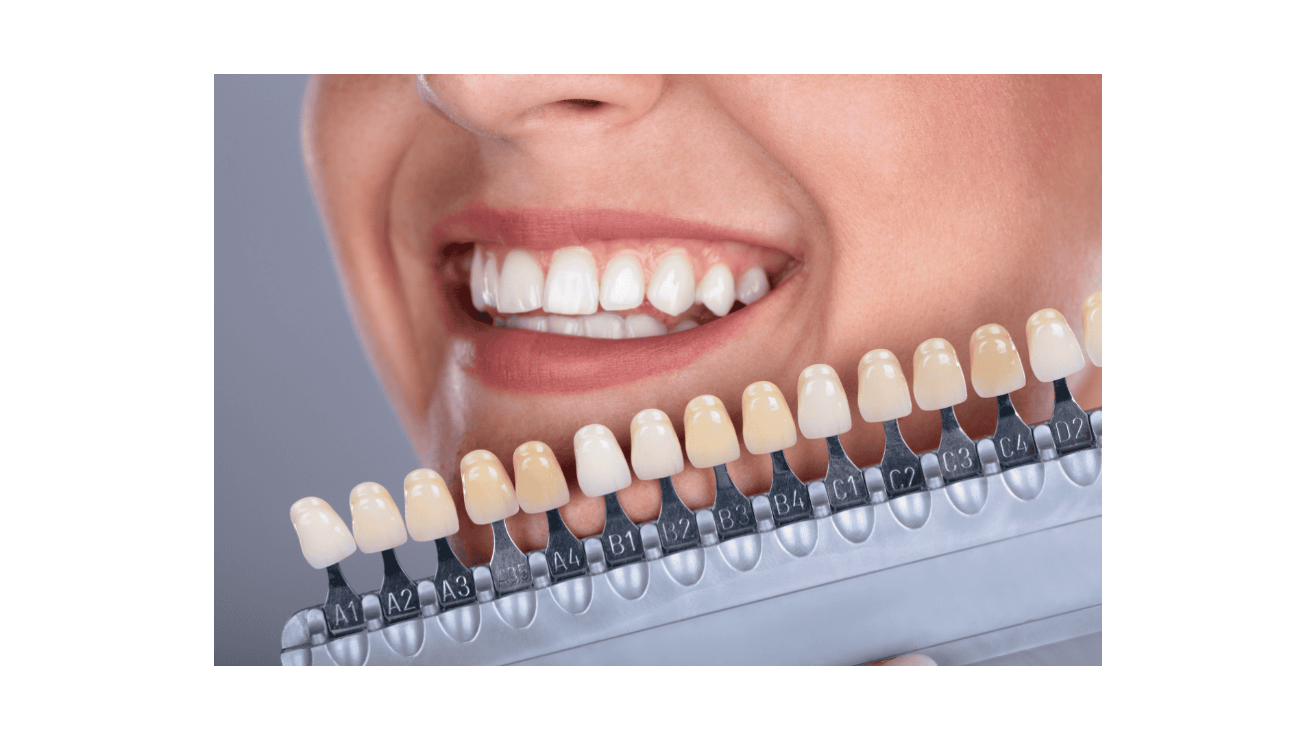 Grincement dents nuit