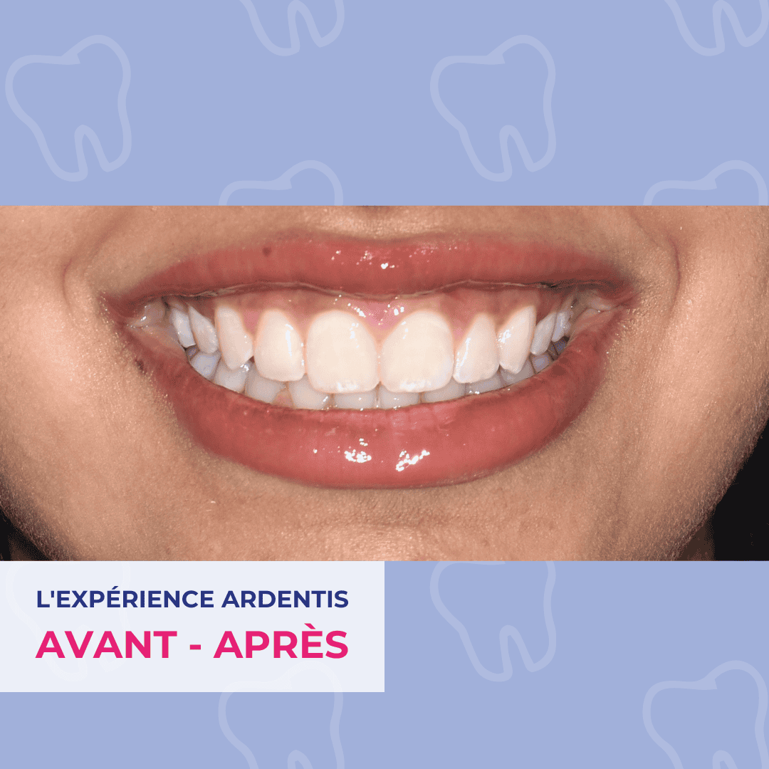 Experience Ardentis