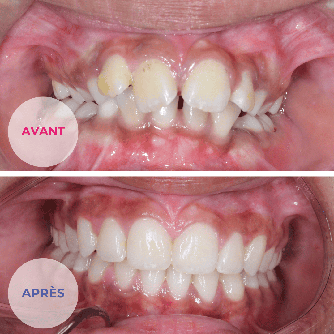 orthodontie